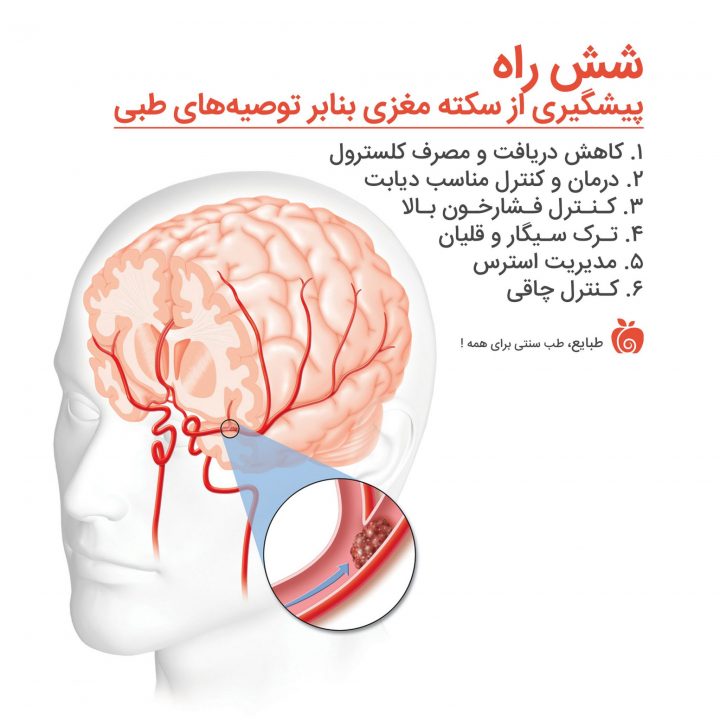 طب سنتی پیشگیری از سکته مغزی
