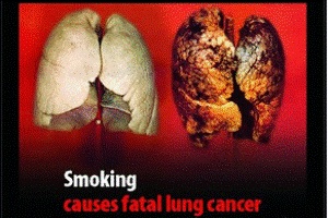 راه جلوگیری از سرطان ریه
