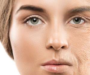 راهای جلوگیری از افتادگی پوست صورت

