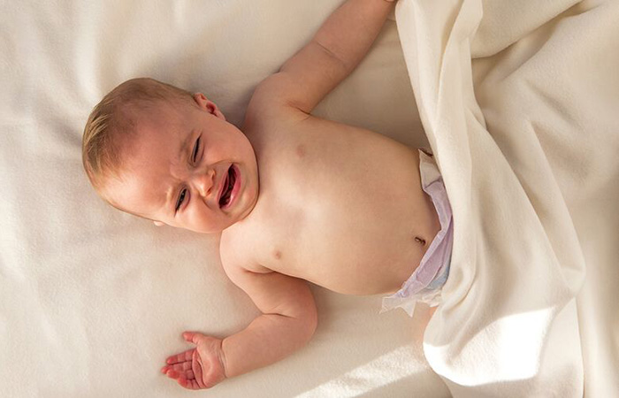 عفونت ادراري در نوزاد
