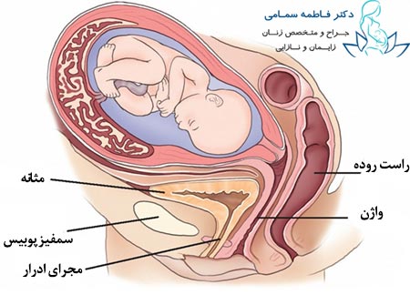 عفونت ادرار در زنان باردار

