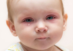 عفونت چشم نوزاد یک ماهه
