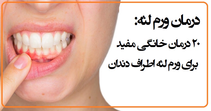 درمان خانگی التهاب لثه دندان عقل
