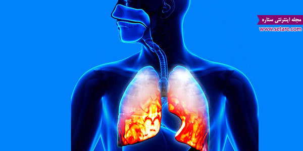 نشانه های عفونت ریه چیست
