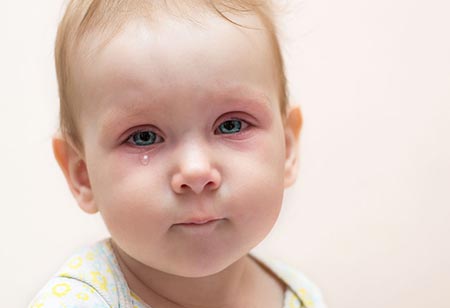 علت عفونت چشم نوزاد و درمان آن
