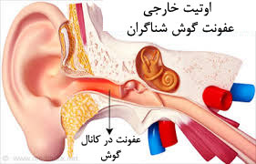 علایم عفونت گوش میانی و درمان
