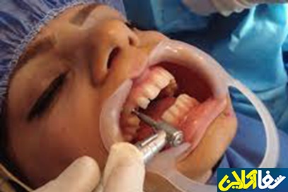 علایم عفونت جای دندان کشیده شده

