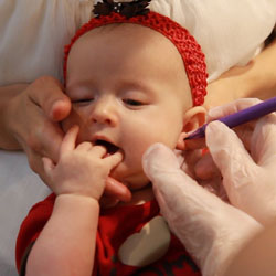 درمان عفونت سوراخ گوشواره کودک
