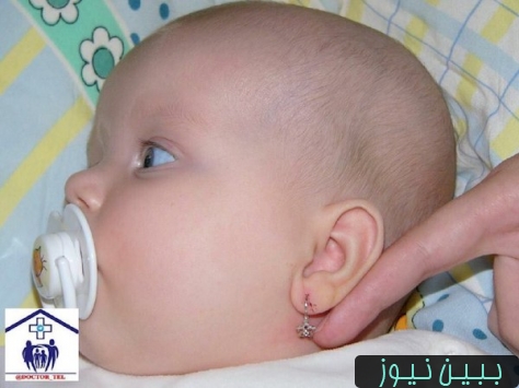 عفونت سوراخ گوش نوزاد
