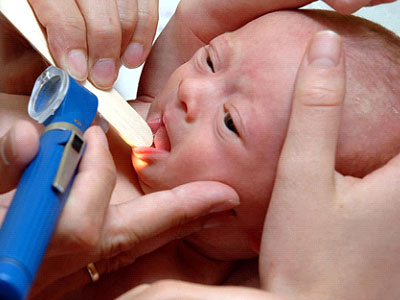 درمان خانگی عفونت گلو نوزادان
