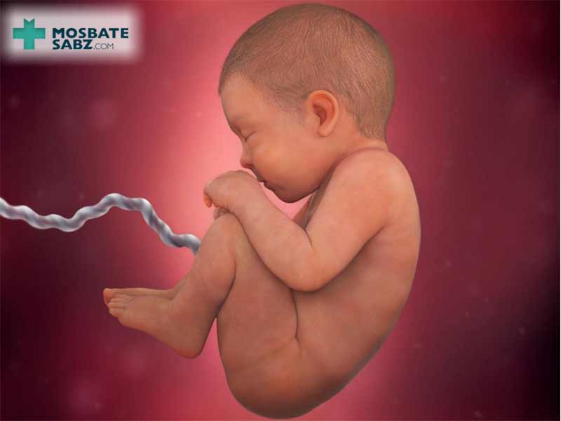درمان کمبود اب کیسه جنین
