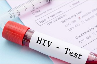 عوامل موثر در مبتلا شدن به ایدز
