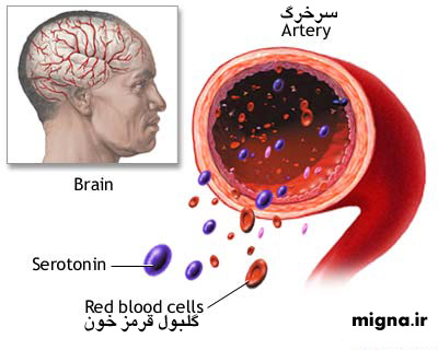 کمبود سروتونین مغز
