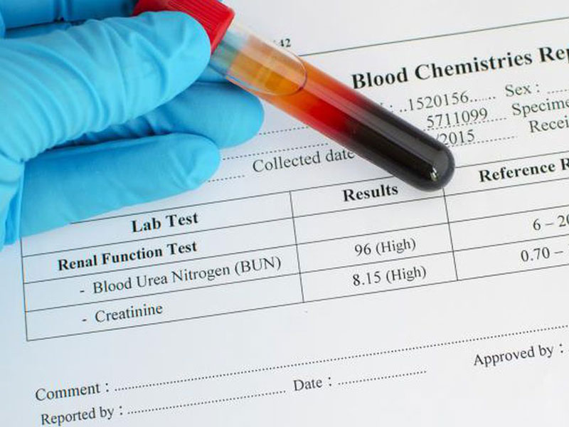 کمبود کراتین در آزمایش خون
