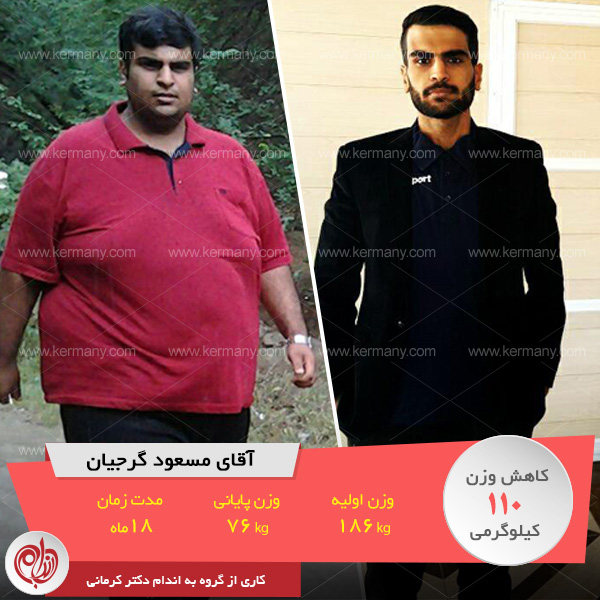 رژیم لاغری دکتر کرمانی برای وزن 90 کیلو
