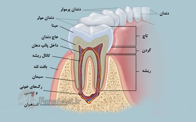 درمان دندان درد عصبی

