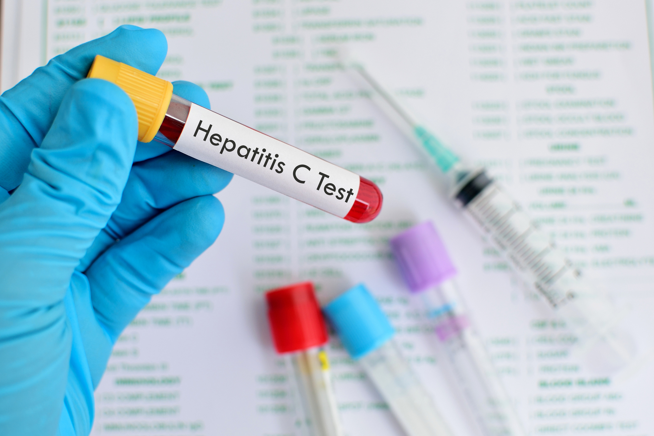 چگونه هپاتیت را تشخیص دهیم

