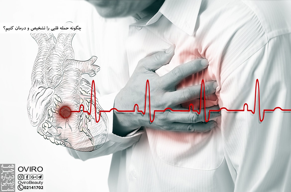 چگونه حمله قلبی را درمان کنیم
