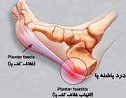 علت درد کف پا سمت چپ

