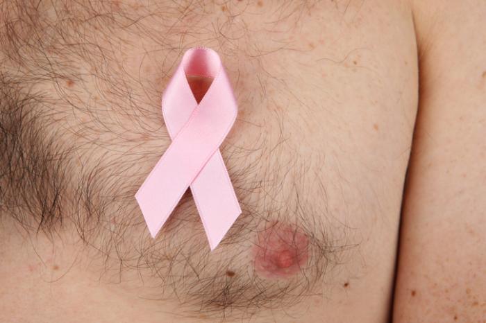 عکس سرطان سينه مردان