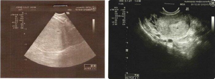عکس سونوگرافی جنین هفته به هفته