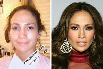 عکس جنیفر لوپز قبل و بعد از عمل زیبایی