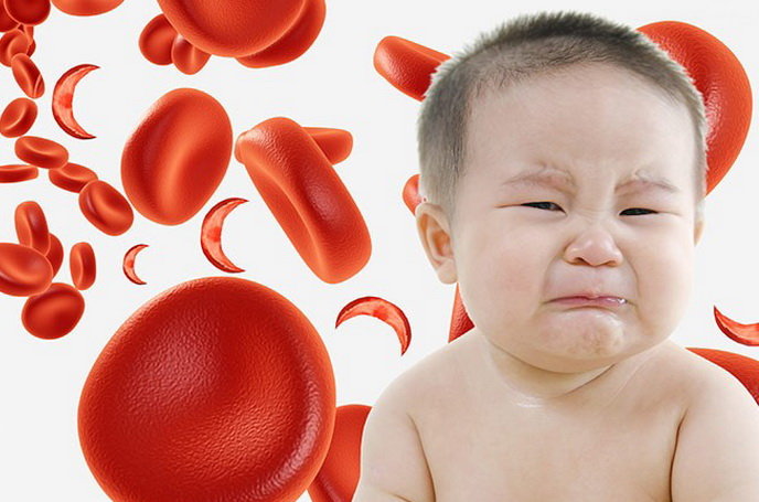 دليل کم خوني در کودکان
