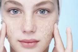 درمان حساسيت پوست صورت
