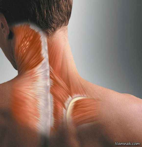 علت گرفتگي عضلات گردن و شانه
