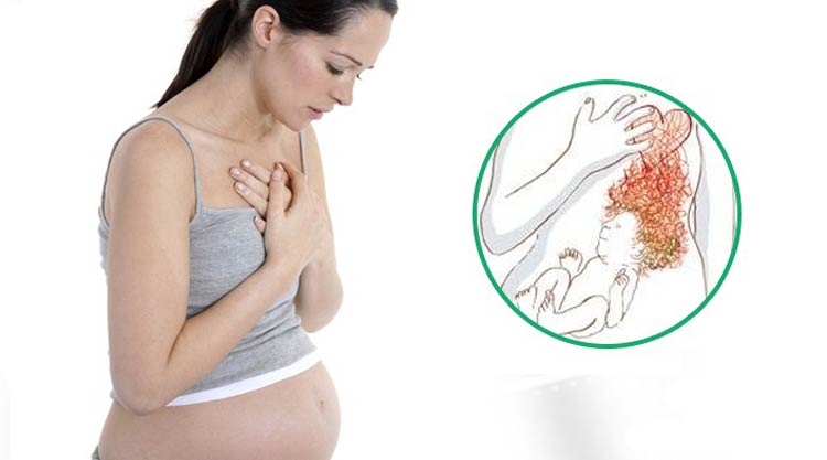 درمان درد معده زن حامله
