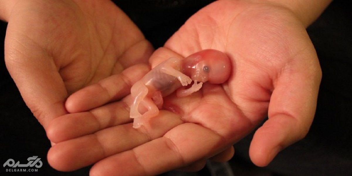 طریقه خوردن زعفران برای سقط جنین 
