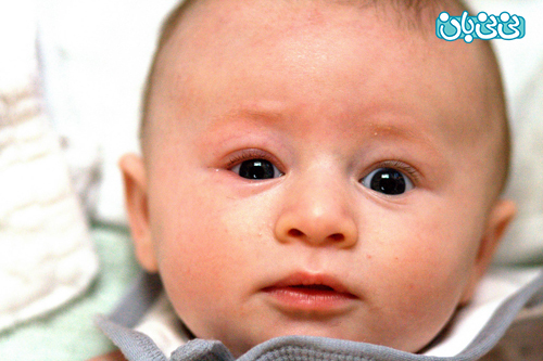 علت عفونت چشم نوزاد یک ماهه
