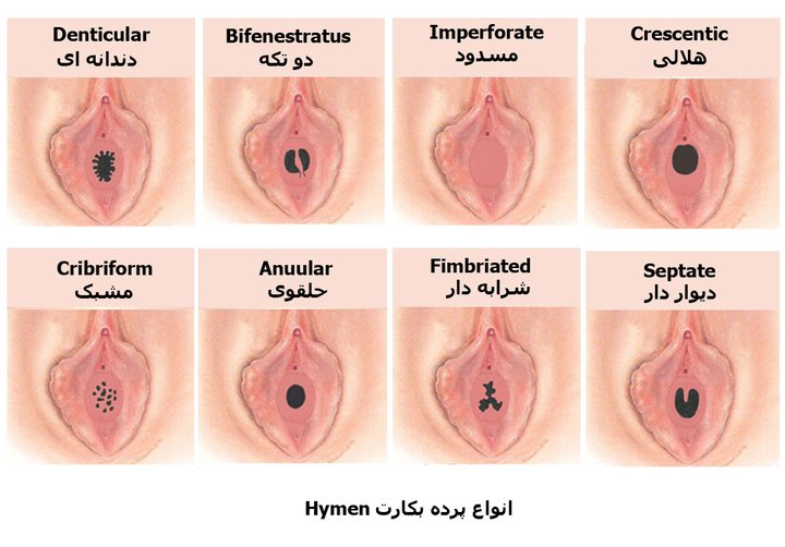 انواع مدل واژن زن
