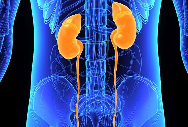 kidney full of stones from soda picture