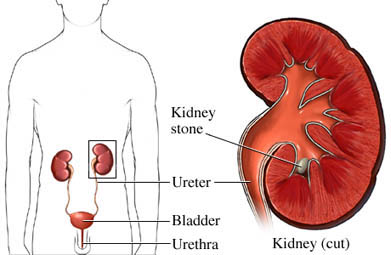 picture of kidney pain area