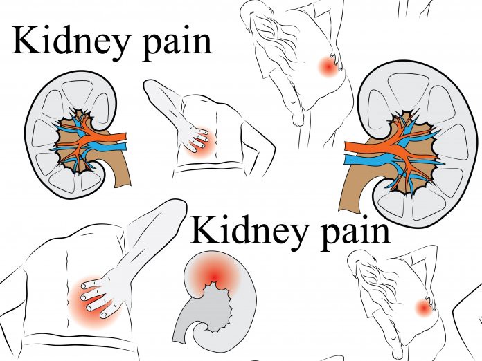 picture of where kidney pain is felt
