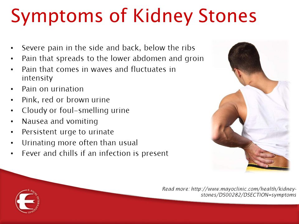 pictures of kidney stone pain