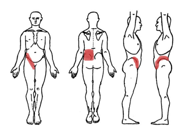 picture of where kidney pain is felt