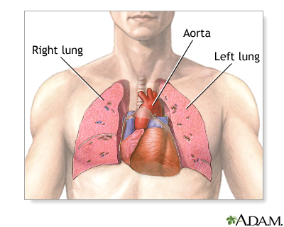 picture of heart and lungs in human body
