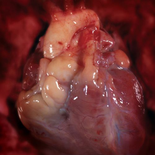 pictures of real human heart