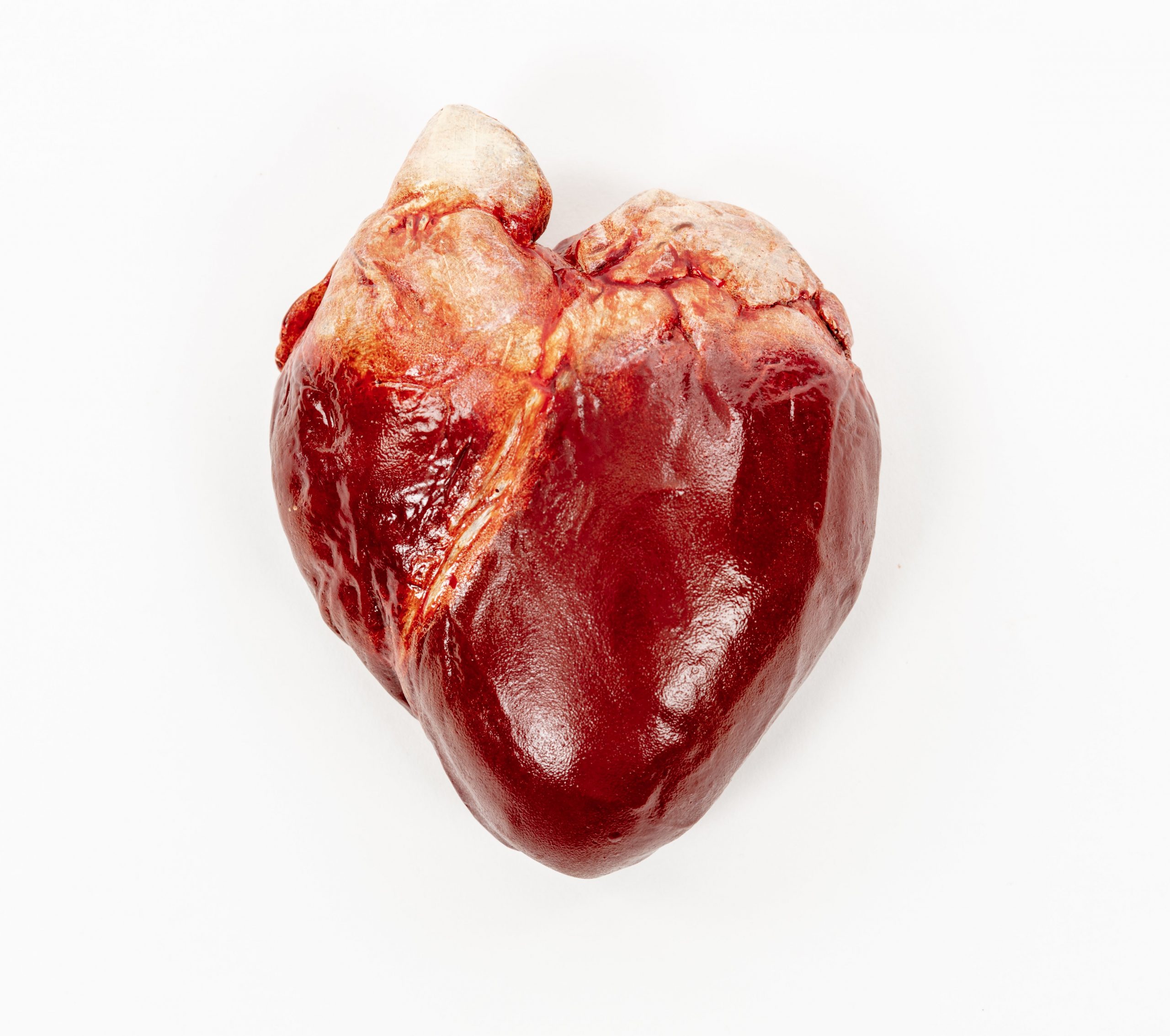 pic of human heart with label