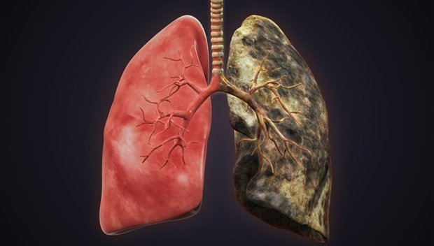 images of damaged lungs due to smoking
