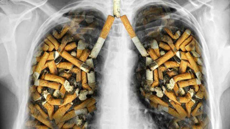 lung cancer photos from smoking