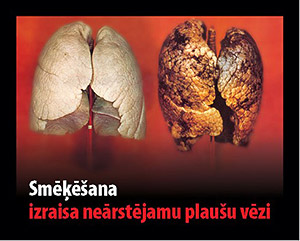 what are the symptoms of lung cancer due to smoking